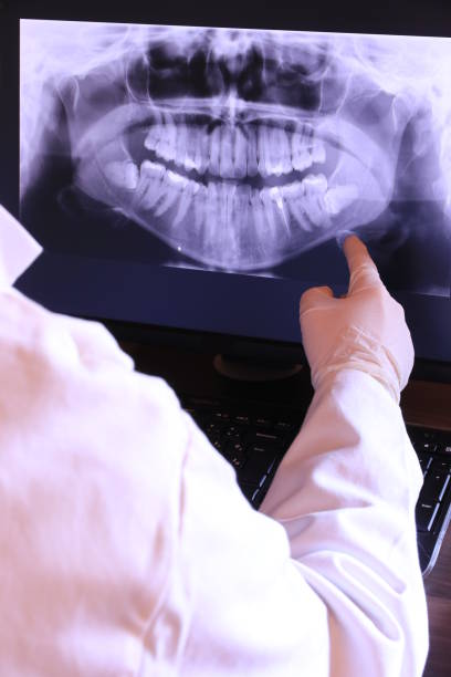 Best Emergency Wisdom Teeth Removal in South Blooming Grove, NY